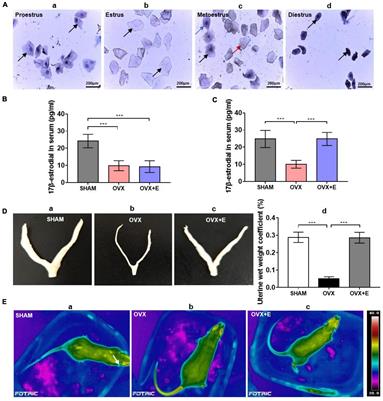 Glutamatergic and GABAergic neurons in the preoptic area of the hypothalamus play key roles in menopausal hot flashes